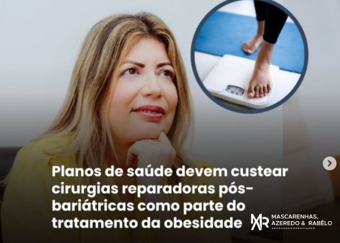 No momento, você está visualizando Plano de saúde devem custear tratamento da obesidade